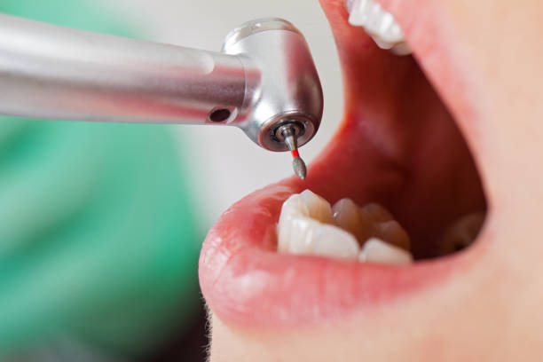 Best Teeth Whitening  in Newport, WA
